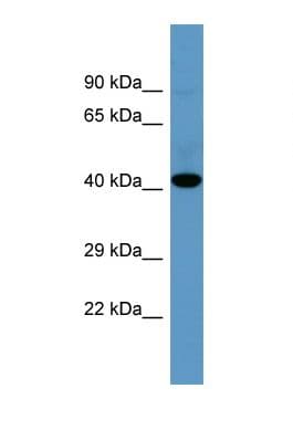 SGK1 / SGK Antibody (aa240-289)