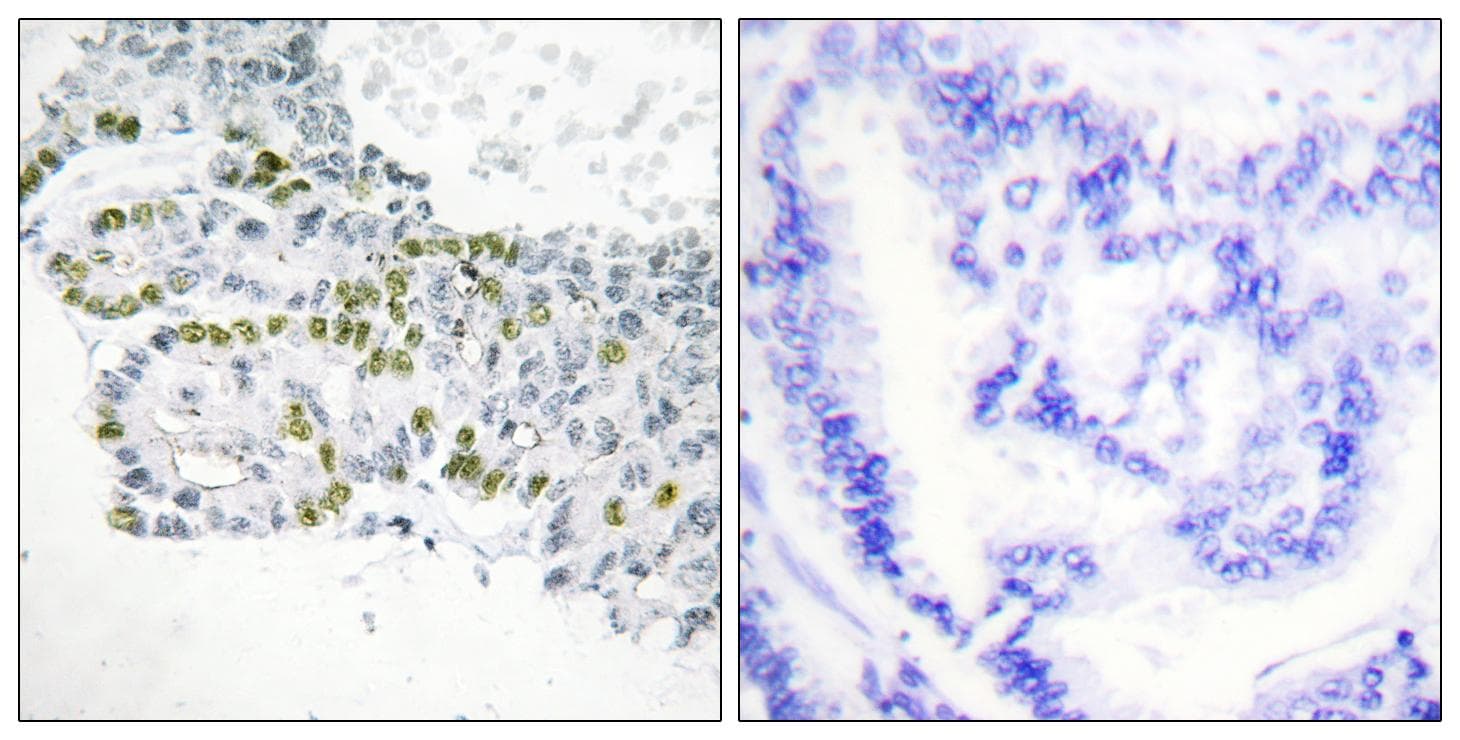 PRKCD / PKC-Delta Antibody (phospho-Tyr52)