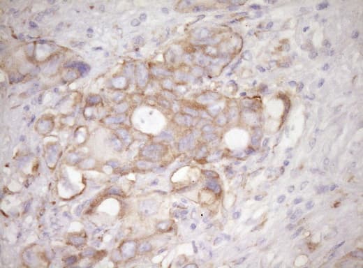 RPL10 / Ribosomal Protein L10 Antibody (clone OTI6B11)