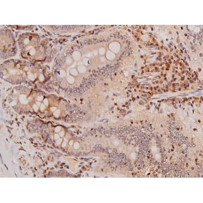 Polyclonal Rabbit anti-Human c-Kit / CD117 Antibody (IHC, IF, WB)