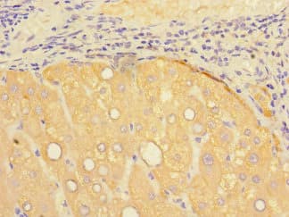 PSEN1 / Presenilin 1 Antibody