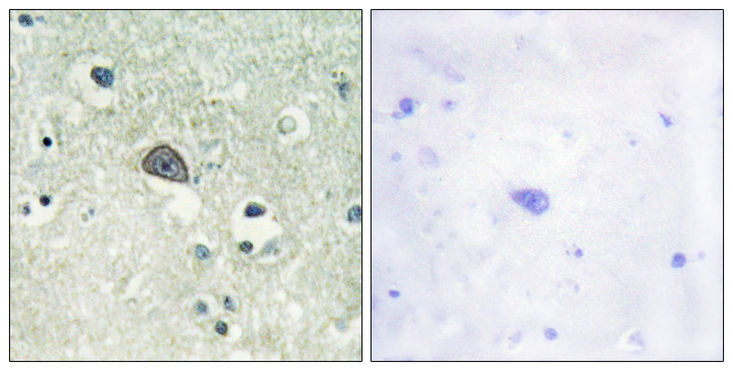 GRIN1 / NMDAR1 Antibody (phospho-Ser890)