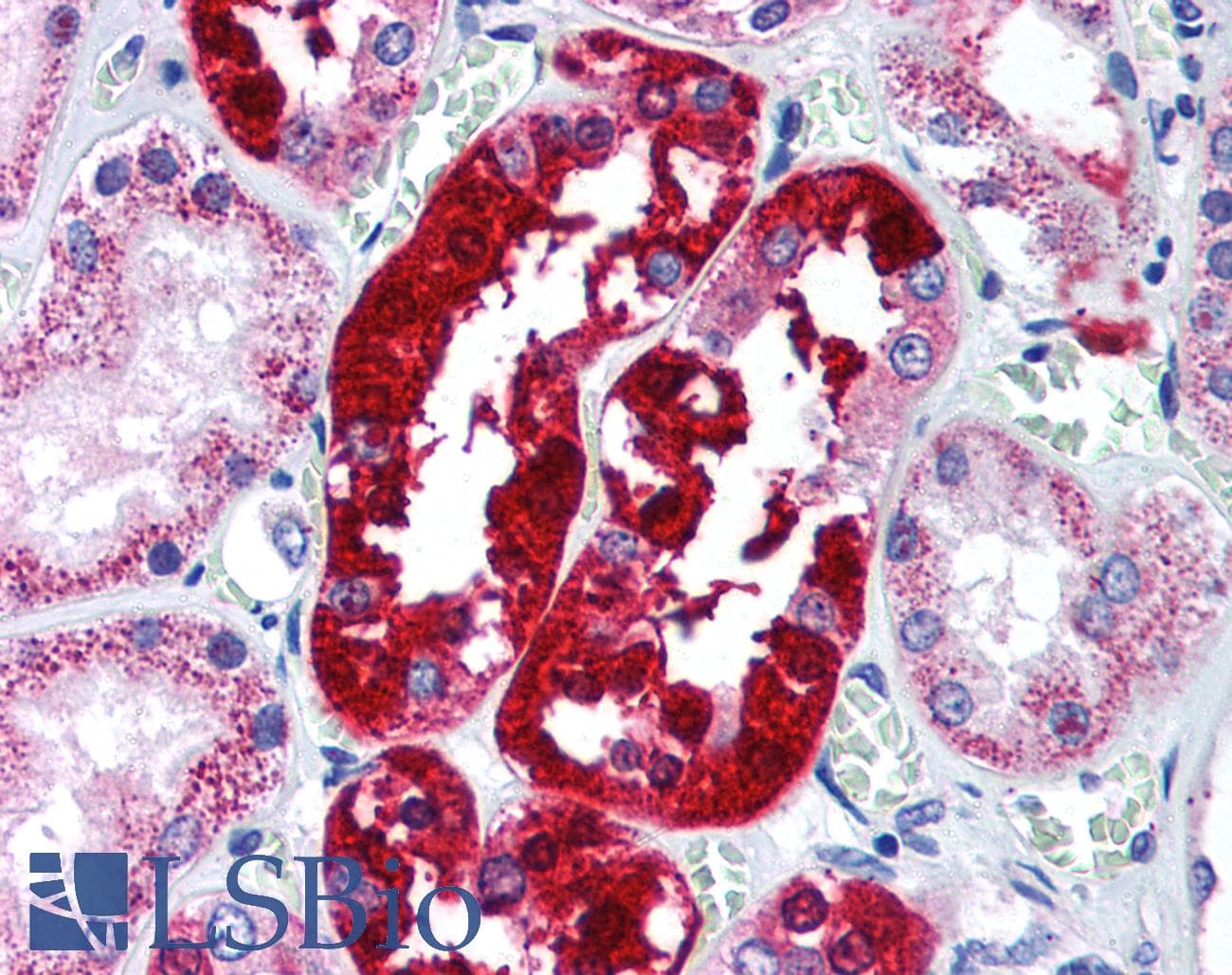 IHC-plus™ Polyclonal Rabbit anti-Human APG5 / ATG5 Antibody (IHC)