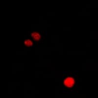 CLIC1 / NCC27 Antibody