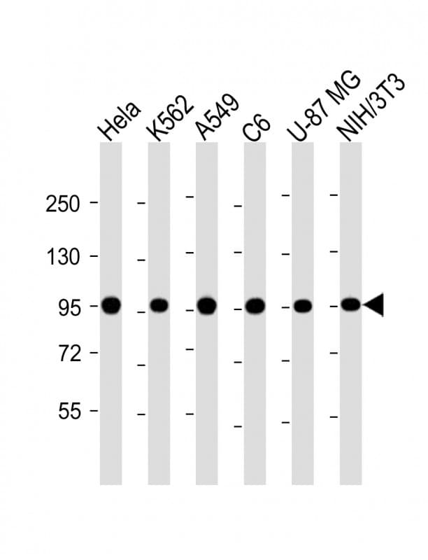 VCP Antibody (clone 1563CT163.48.77)