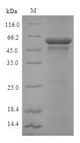 Arabidopsis thaliana ADH5 Protein (Recombinant 6His-SUMO, N-terminus)