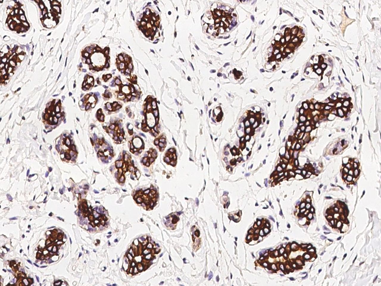 Polyclonal Rabbit anti-Human KRT17 / CK17 / Cytokeratin 17 Antibody (IHC, IF)