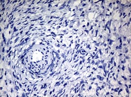 NBN / Nibrin Antibody (clone OTI3A9)
