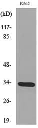 SFTPA1 + SFTPA2 Antibody