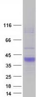 Human SCN3B Protein (Recombinant Myc-DDK (Flag))