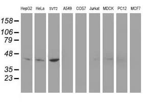 NUDEL / NDEL1 Antibody (clone OTI5E11)