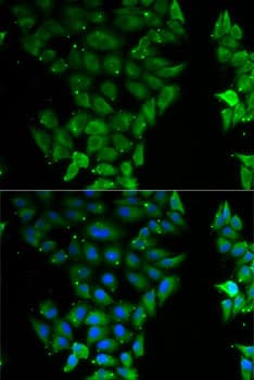 ELF3 / ESE1 Antibody