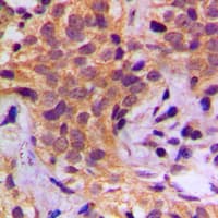 Polyclonal Rabbit anti-Human HSP90AB1 / HSP90 Alpha B1 Antibody (phospho-Ser254, IHC, IF, WB)