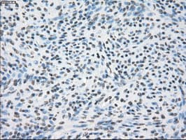 CRYAB / Alpha B Crystallin Antibody (clone OTI6G5)