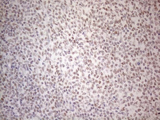 MMP2 Antibody (aa228-507, clone OTI4A11)