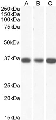 IHC-plus™ MDH / MDH2 Antibody (aa221-232)