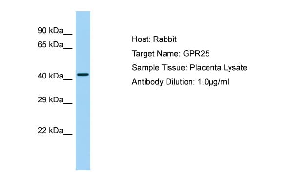 GPR25 Antibody (aa166-215)