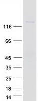 Human ITGAE / CD103 Protein (Recombinant Myc-DDK (Flag))