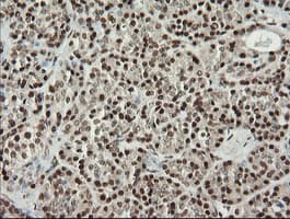 MCTS1 Antibody (aa1-181, clone OTI2F9)