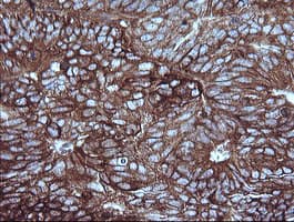 MAP2K1 / MKK1 / MEK1 Antibody (clone OTI2D2)