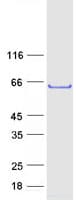 Human TULP3 Protein (Recombinant Myc-DDK (Flag))