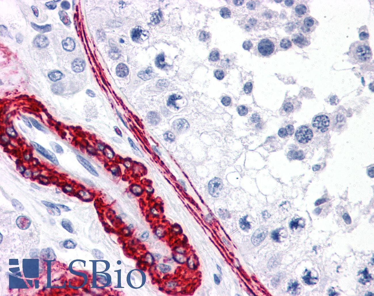 IHC-plus™ Polyclonal Rabbit anti-Human CARD10 / CARMA3 Antibody (IHC)