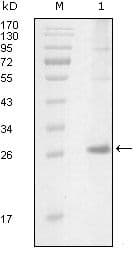 ITK / EMT Antibody (Amino Acid: 2-110, clone 5G12C4)