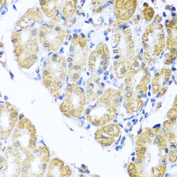 NIX / BNIP3L Antibody