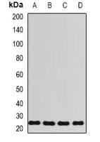 RPL13 / Ribosomal Protein L13 Antibody