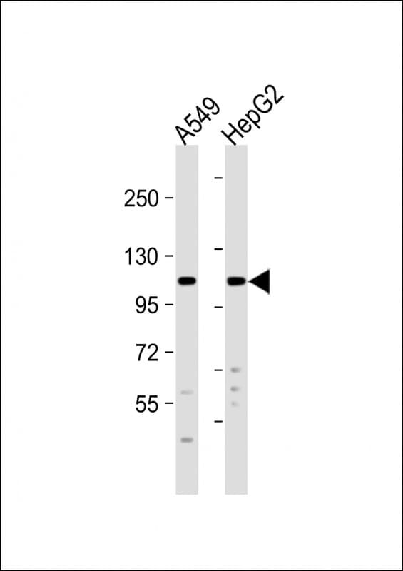 EIF2AK3 / PERK Antibody (Internal)