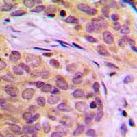 HSP70L1 / HSPA14 Antibody (C-Terminus)