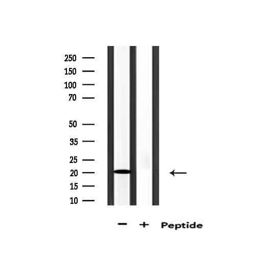 AK6 / Adenylate Kinase 6 Antibody