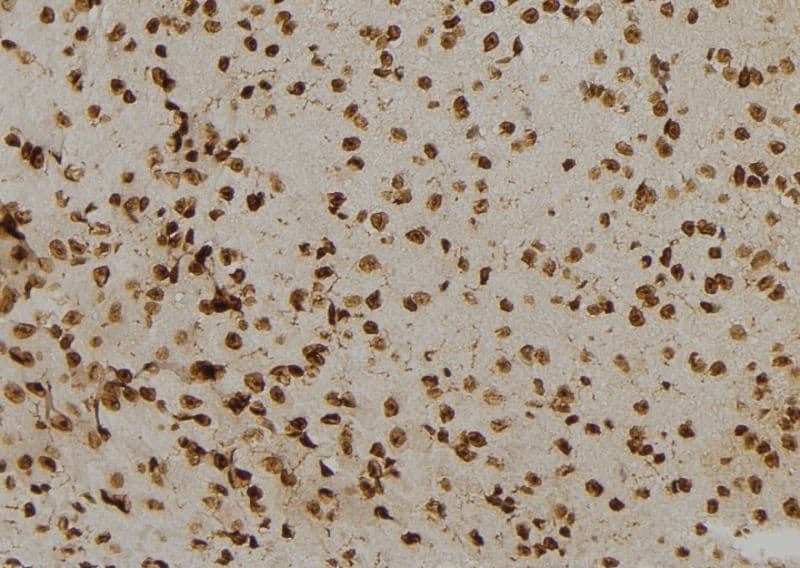 Polyclonal Rabbit anti-Human NUMBLIKE / NUMBL Antibody (IHC, IF, WB)