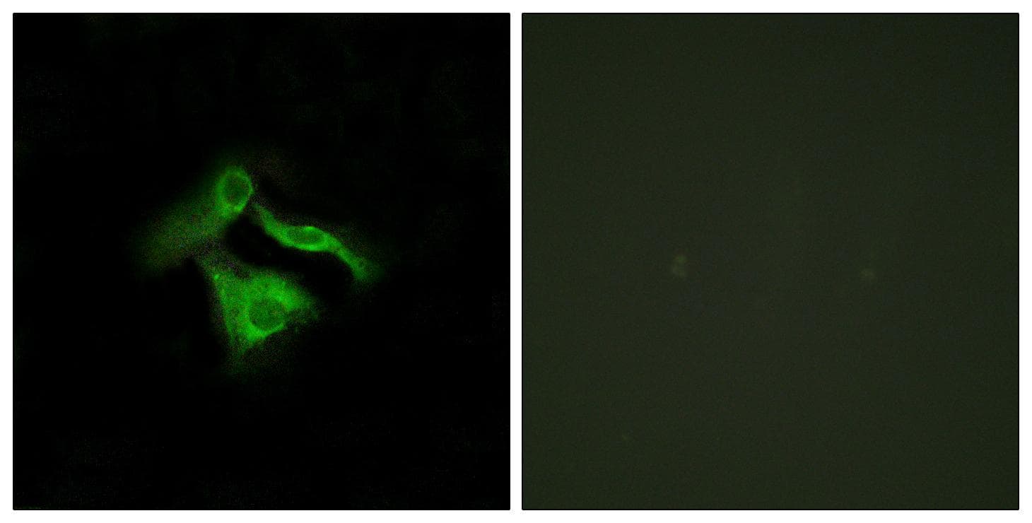 Polyclonal Rabbit anti-Human GPR149 / PGR10 Antibody (IF, WB)