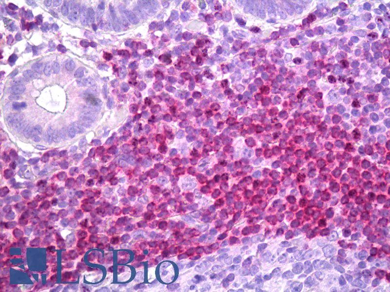 IHC-plus™ BCL2 / Bcl-2 Antibody (clone 11C5)