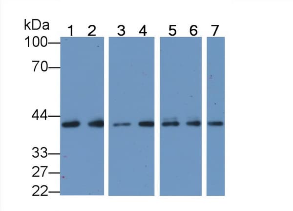 ACTC1 / Alpha Cardiac Actin Antibody