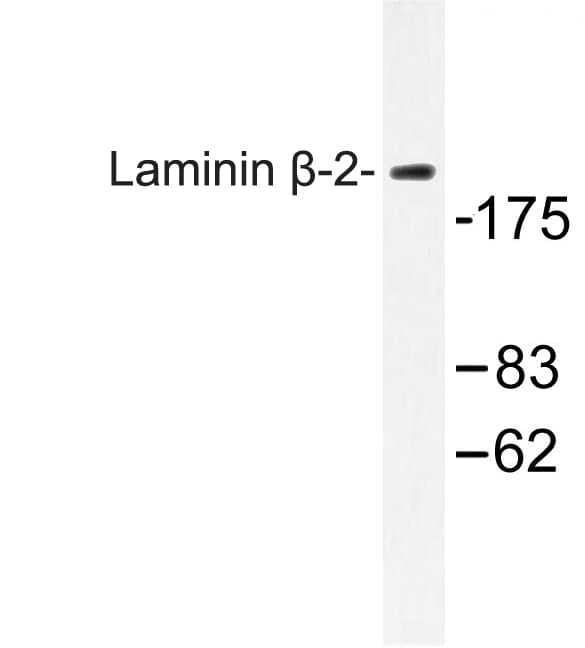 LAMB2 / Laminin Beta 2 Antibody (Cys91)