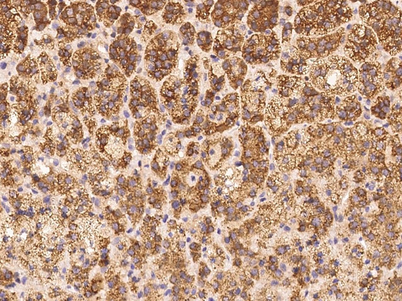 SCARA5 Antibody