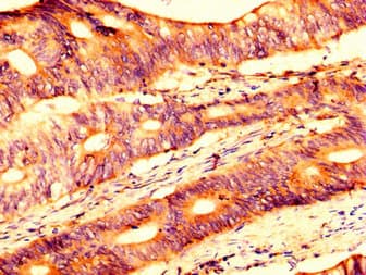 Polyclonal Rabbit anti-Human USP4 Antibody (IHC, IF, WB)