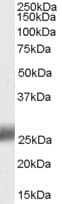 SRD5A2 Antibody (aa2-13)