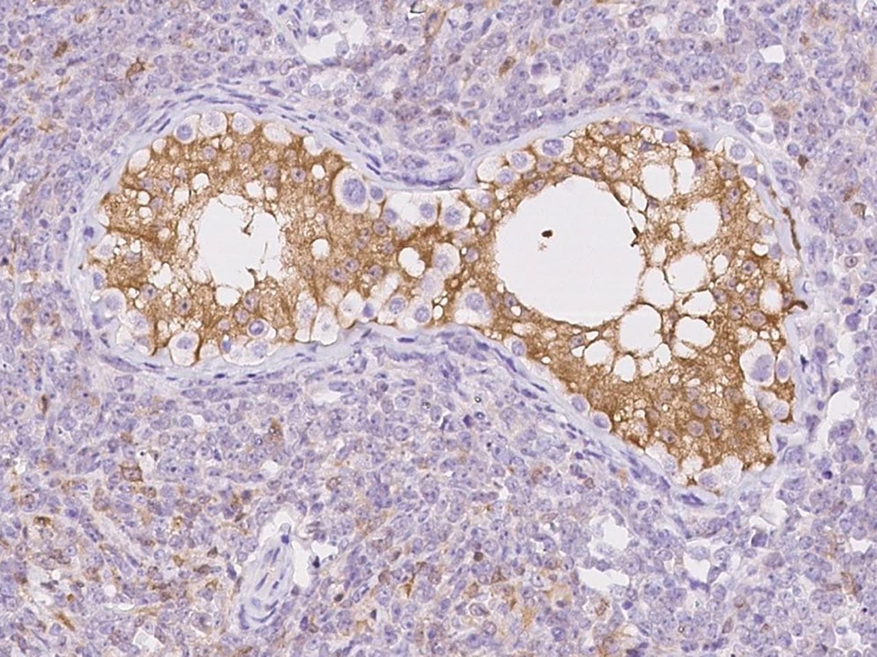 Polyclonal Rabbit anti-Human GMPR1 / GMPR Antibody (IHC)