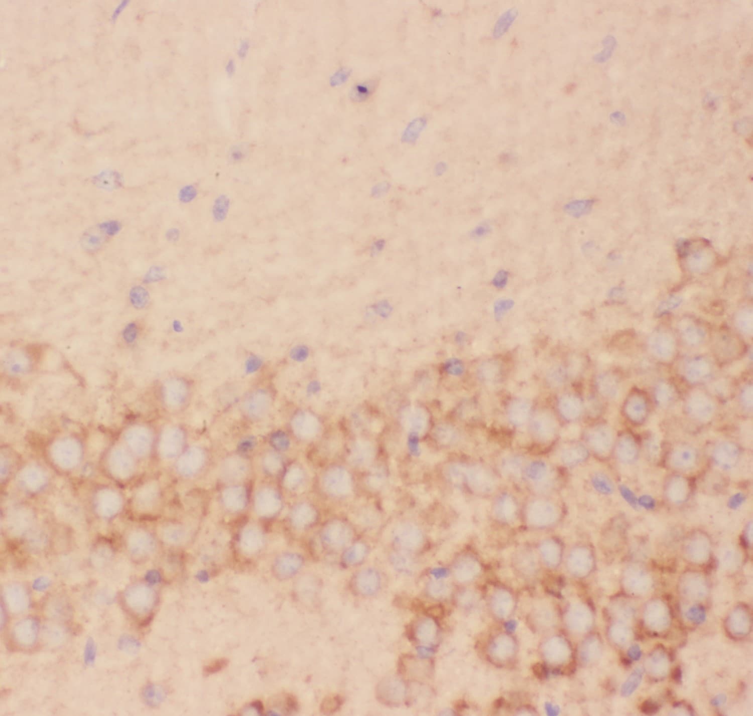 FSHB / FSH Beta Antibody (aa19-129)