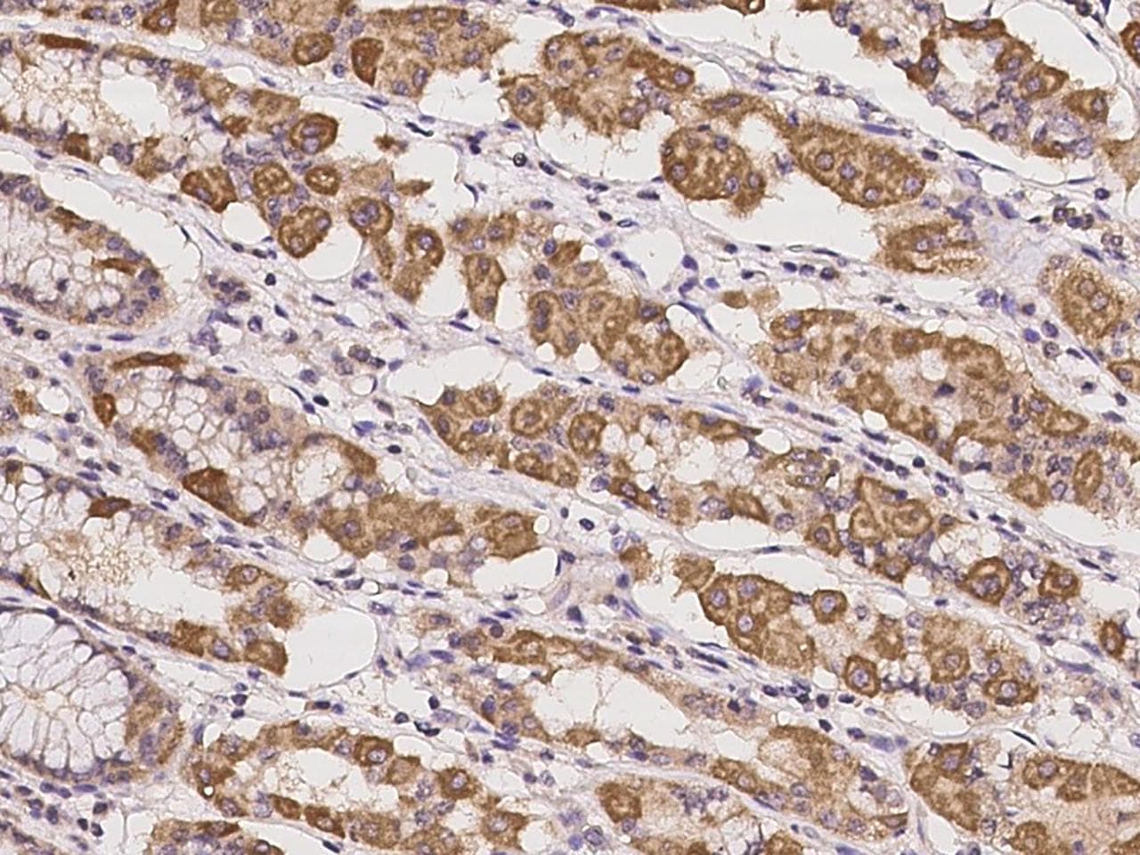 KCTD17 Antibody