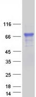 Human STS / ASC / Steroid Sulfatase Protein (Recombinant Myc-DDK (Flag))