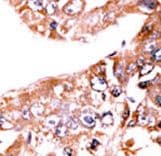 STAT1 Antibody (phospho-Ser727)