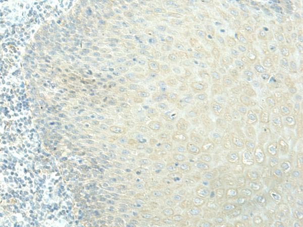 Polyclonal Rabbit anti-Human EVI2B Antibody (IHC)
