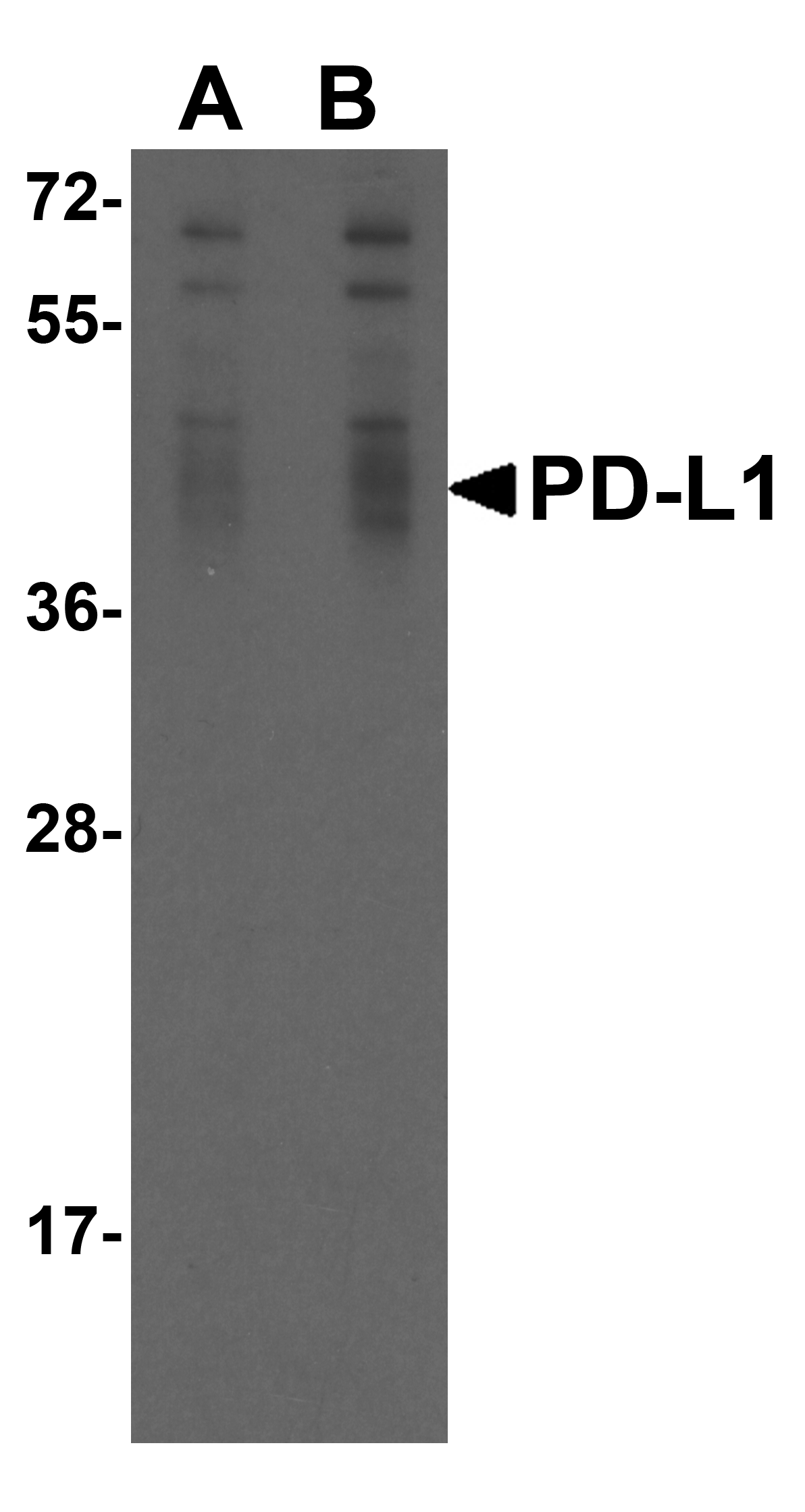CD274 / B7-H1 / PD-L1 Antibody (clone 6H10)