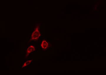 Polyclonal Rabbit anti-Human MRPS16 Antibody (aa41-66, IHC, IF, WB)