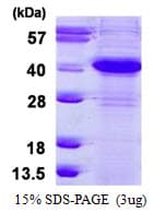 Human ERCC1 Protein (Recombinant His)
