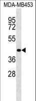 RBM4 / LARK Antibody (aa334-362)